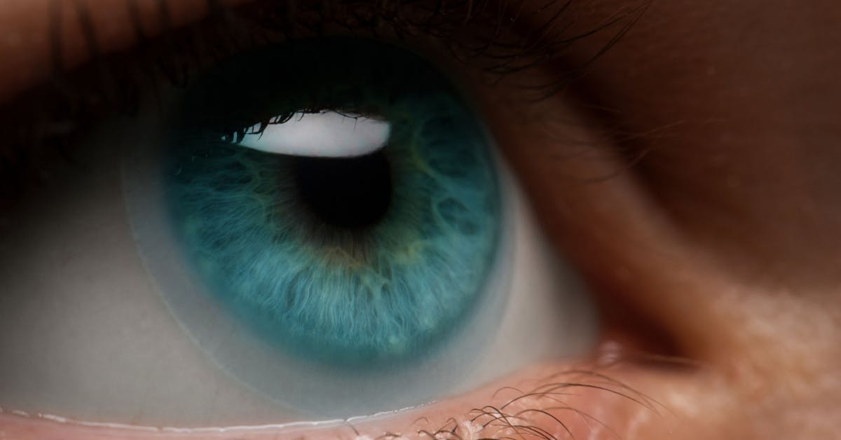 GoldenEye Antibiotic Ointment Reviews medino